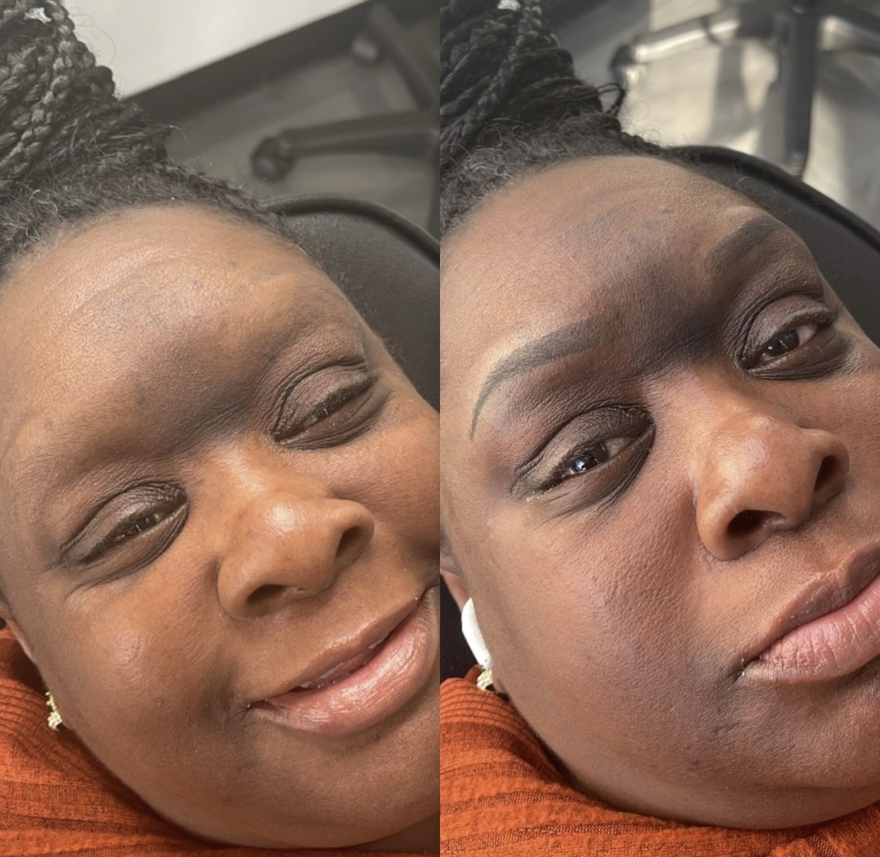 Brow result